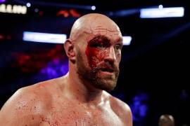 Tyson Fury iba a enfrentar a Oleksandr Usyk el próximo 17 de febrero, sin embargo, una lesión no la permitirá.