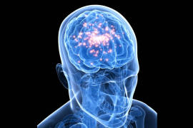 Epilepsia afecta hasta a un 2% de la población: especialista