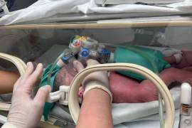 Las siamaesas llegaron al mundo el pasado 15 de marzo en el Hospital Regional Materno Infantil, en Monterrey, Nuevo León/FOTO: CORTESÍA