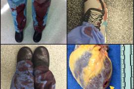 Médicos estadounidenses se enfrentan a la Asociación Nacional del Rifle con los hashtags #thisismylane y #thisisourlane