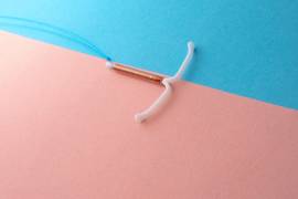 Cada vez con más frecuencia las mujeres recurren al dispositivo intrauterino, o DIU, como método anticonceptivo.