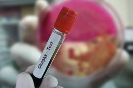 Mantener la etiqueta de ‘no endémica’ contribuyó a la falta de diagnóstico, la escasa formación médica y la subestimación de su impacto. FOTO.