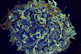En esta imagen microscópica coloreada se muestra una célula T humana, de color azul, atacada por el VIH (en amarillo), el virus que causa el sida.