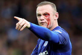 Rooney recibe un brutal codazo en el rostro