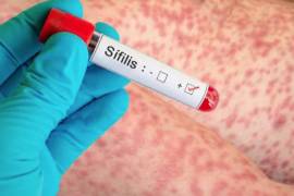 El mayor incremento se presentó en la segunda semana de febrero, con 149 nuevos diagnósticos en la entidad.