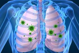 Durante julio y agosto, Coahuila registró 296 casos de neumonía, sumando más de 3 mil atenciones en lo que va del año.