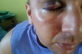 Erick Daniel presenta hematomas considerables en el área del rostro tras las agresiones sufridas al interior del centro de rehabilitación.