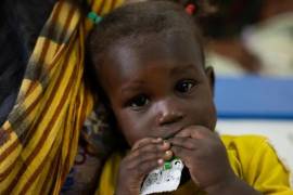 Un bebé de un año recibe tratamiento para la desnutrición en Sudán.