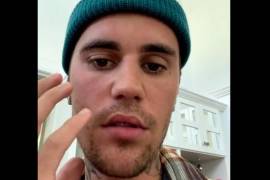 Bieber explica que está realizando una serie de ejercicios faciales a diario para recuperar su normalidad cuanto antes, pero que no está claro cuánto tiempo le llevará.