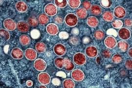 Una micrografía electrónica de transmisión coloreada de partículas de viruela del simio (rojas) encontradas dentro de una célula infectada (azul), cultivadas en el laboratorio que fue capturada y coloreada en el NIAID.