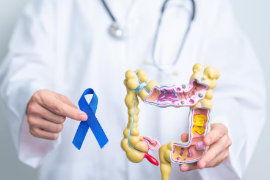 El cáncer colorrectal es una de las principales causas de muerte por tumores malignos en Coahuila y México.