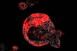 Una investigación del IRB de Barcelona que fue publicada en la revista ‘Nature’, logró identificar cuáles son las células malignas responsables de la recaída en el cáncer de colon que originan las muertes por metástasis.