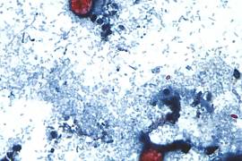 En esta imagen se observan ooquistes de Cyclospora cayetanensis en una muestra fresca de heces preparada con una solución de formalina y teñida con safranina.