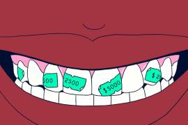 No siempre es necesario empastar una caries. Es importante saber evaluar las diferentes opciones dentales.