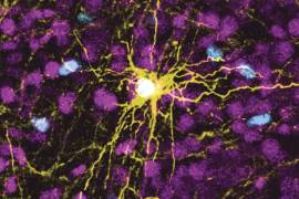 Esta imagen de microscopio proporcionada por Pasca Lab/Stanford Medicine muestra un astrocito humano, con el centro en amarillo, y células gliales humanas (dispersas en azul) dentro del cerebro de una rata.