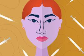 La rinoplastia, que suele costar entre 5000 y 15.000 dólares en Estados Unidos.