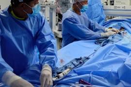 La técnica sustituye la cirugía a corazón abierto, reduciendo riesgos.