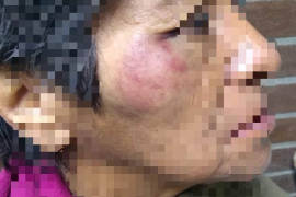 Policías de Arteaga golpean y gasean a dos mujeres