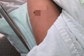 La menor fue trasladada al Hospital del ISSSTE de Monclova luego de que un lápiz se incrustara profundamente en su pierna tras una caída en el salón de clases.
