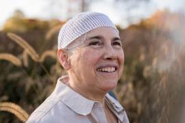 El sistema TTFields produce campos eléctricos y los transmite a través de parches transductores adhesivos que se colocan en el cuero cabelludo del paciente.