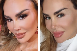 Los oftalmólogos alertan que estas cirugías pueden causar daños permanentes en la vista.