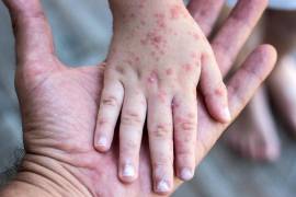 Se mantienen en vigilancia 156 casos sospechosos.