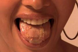 Modelos se cosen la lengua para bajar de peso