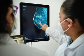 Mientras suben los números de diagnósticos de cáncer, baja la capacidad del Estado para atenderlos, expone la Fundación Beatriz Beltrones.