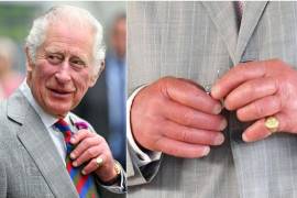 Las hipótesis que plantearon los especialistas de todo el mundo en los últimos días, las principales apuntan a problemas cardíacos, renales o reumatológicos.