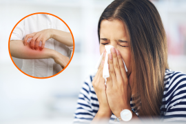 Comprender las diferencias es crucial: las alergias son respuestas del sistema inmunológico a alérgenos, mientras que la gripe es una infección viral