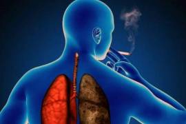 El tabaco es la principal causa del cáncer de pulmón; evítelo.