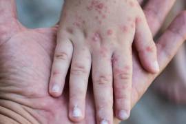 Alumnos deberán cumplir con medidas sanitarias mientras se confirma el alcance del brote.