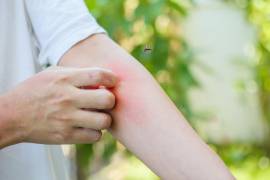 Autoridades municipales coordinan trabajos de descacharrización en Frontera para prevenir la propagación del mosquito Aedes aegypti.