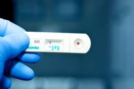 En contraste, los contagios de herpes genital experimentaron una disminución en el mismo periodo.