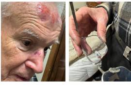 Raúl Vera López mostró en redes sociales las lesiones que sufrió tras caer en una banqueta del Centro Histórico de Saltillo.