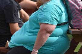 Especialista manifiesta su preocupación sobre las consecuencias del sobrepeso y obesidad.