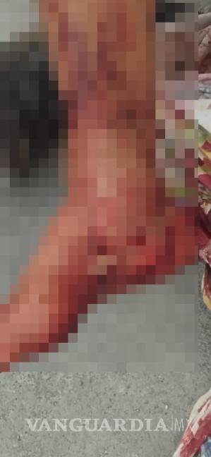 $!Bryan Alberto ¨N¨ fue atendido en el lugar antes de ser enviado a su domicilio para descansar después de recibir curaciones en el pie.