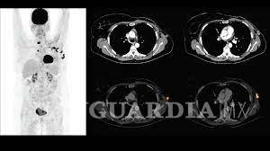 $!El calvario del cáncer en una pandemia, mujeres comparten su testimonio de lucha