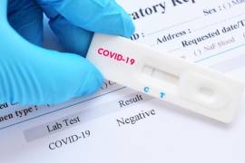 Las personas que hayan presentado un cuadro grave de coronavirus, o bien, sean pacientes inmunodeprimidos, pueden seguir siendo contagiosos los siguientes 20 días desde la aparición de los primeros síntomas.