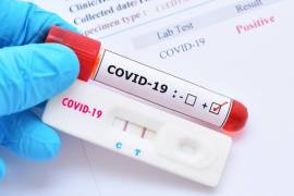 En los 117 centros de salud de la Ciudad de México que realizan la prueba, los habitantes llegan desde las primeras horas para realizarse un test de COVID-19