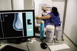 El Hospital General Dr. Salvador Chavarría Sánchez realizó más de mil mastografías gratuitas durante 2025, dirigidas a mujeres de entre 40 y 69 años.