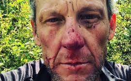 El terrible accidente que sufrió Lance Armstrong