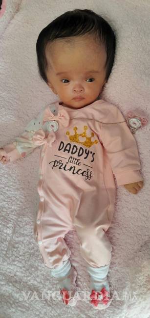 Familia en Saltillo solicita apoyo para bebé con hidrocefalia congénita