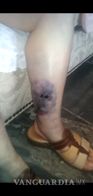 Denuncian por maltrato y lesiones a asilo de adultos mayores de Saltillo