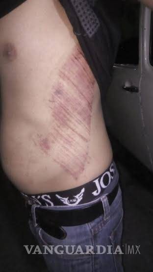 $!Oficiales de Fuerza Coahuila allanan casa en Saltillo, golpean a jóvenes; MP los libera
