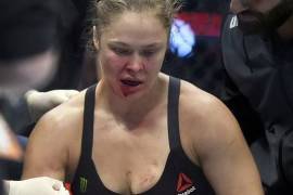 Ronda Rousey a punto de perder el dedo en México (foto)