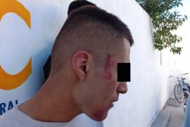 Tres jóvenes fueron encontrados atados de pies y manos con hematomas en rostro y cuerpo, en una de las habitaciones del centro.