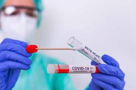 La Cruz Roja practica hasta 4 pruebas COVID-19 al día; reporta una positividad del 50 por ciento.
