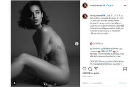 Esmeralda Pimentel se quita la ropa... y presume sus estrías