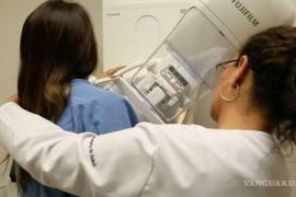 Mujeres de 40 años son alentadas a someterse a una mastografía anual para la prevención del cáncer de mama.